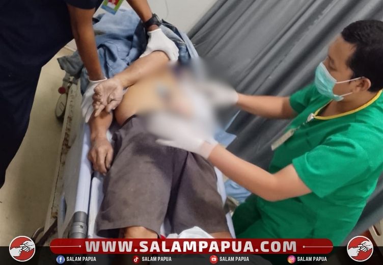 Seorang Pengendara Sepeda Motor Meninggal Dunia Usai Tersenggol Mobil Dan Menabrak Median Jalan
