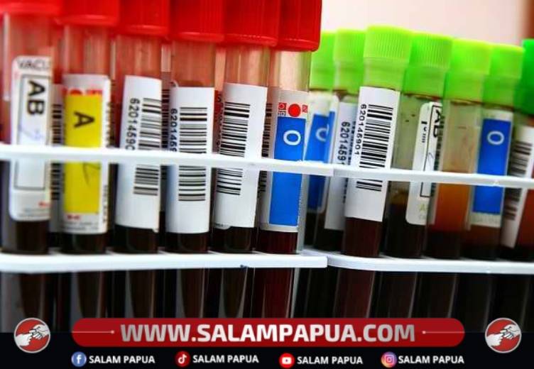 Golongan Darah A, B, AB, Dan O, Ketahui Masing-Masing Karakteristiknya