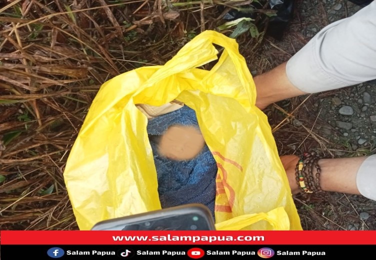 Bayi Yang Ditemukan Di Kompleks Jembatan Waker Alami Gangguan Pernapasan Dan Infeksi