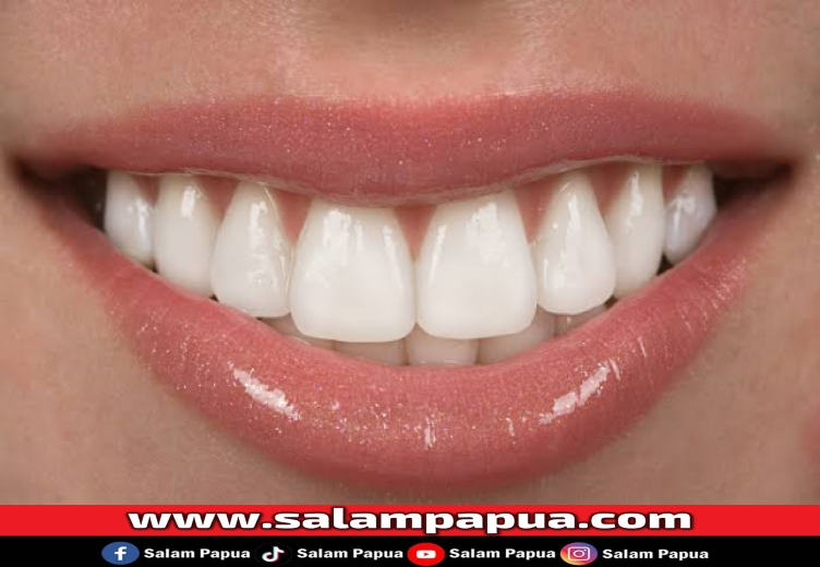 5 Cara Memutihkan Gigi Dengan Bahan-Bahan Di Rumah